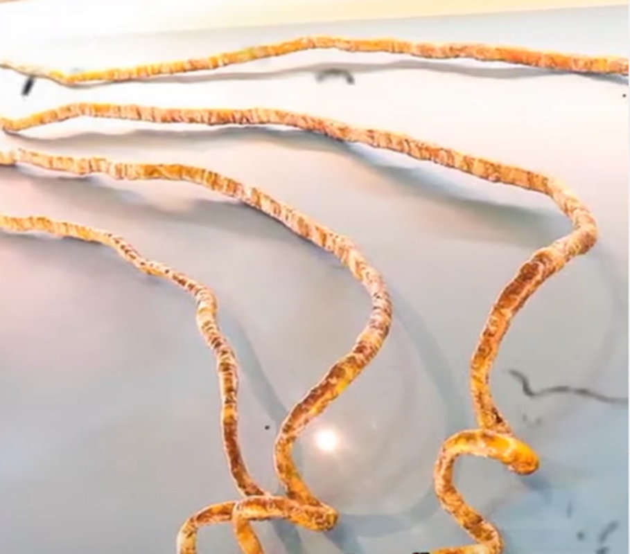 Guinness Book: O homem que ficou mais de 60 anos sem cortar as unhas (Imagens fortes) 4 Unhas cortadas de Shridhar Chillal expostas sobre superfície branca em museu