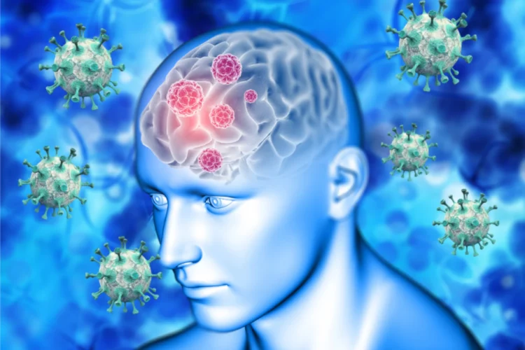 Vírus Nipah pode chegar ao Brasil? Ministério da Saúde explica 1 Imagem ilustrativa sobre o vírus Nipah, com destaque para células cerebrais e partículas virais.