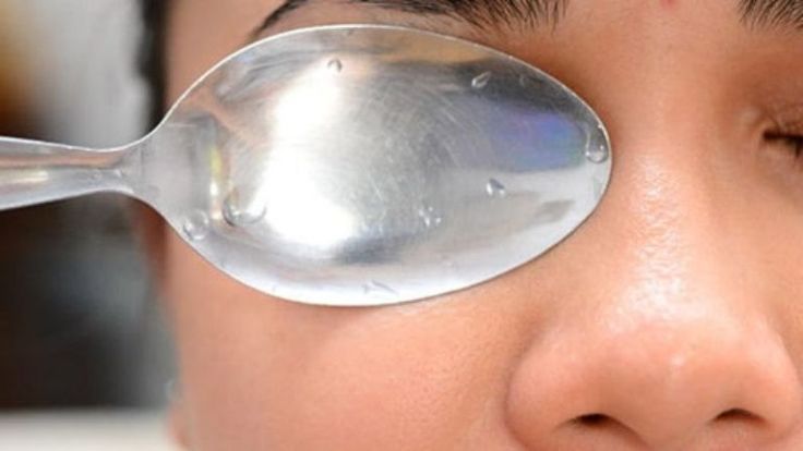 O truque da colher que realmente funciona para amenizar as olheiras 2 pessoa com olhos fechados, posicionando o dorso de uma colher de metal gelada, com gotículas de condensação, sobre a pálpebra e região das olheiras.