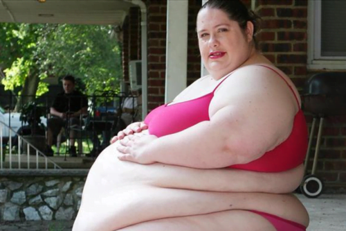 mulher obesa tj sp