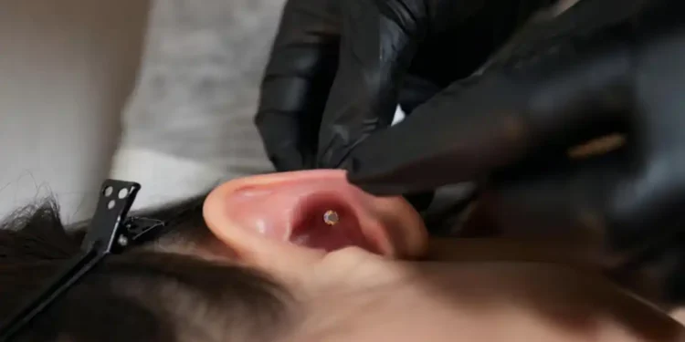 Imagem detalhada de um piercing recém-feito, com foco na área do furo e cuidados de cicatrização.