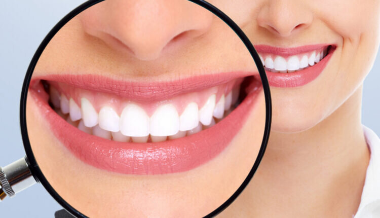 4 dicas de como clarear os dentes em casa - Reprodução Canva