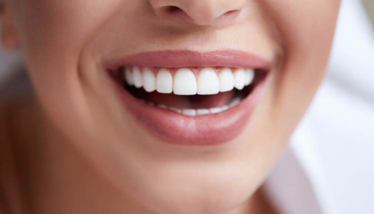dicas para cuidar da saúde dos dentes