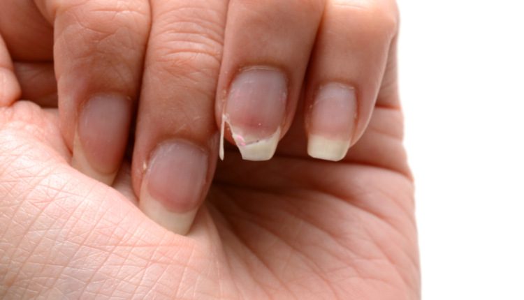 razões pelas quais as suas unhas podem estar quebrando