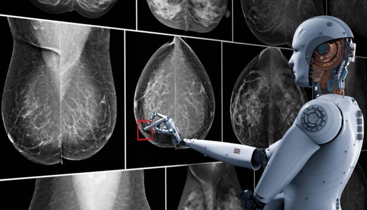 Veja o impacto da Inteligência Artificial para a detecção do câncer de mama