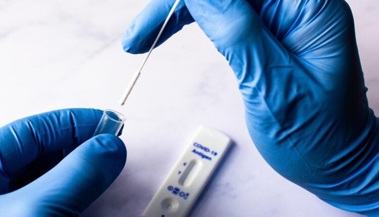 NOVOS TESTES em farmácias: Confira agora quais são as diferenças para exames de laboratórios