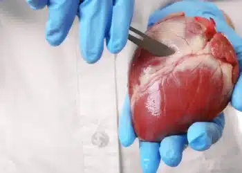 Coração humano sendo manipulado com bisturi, ilustrando o fenômeno de continuar batendo por alguns segundos fora do corpo.