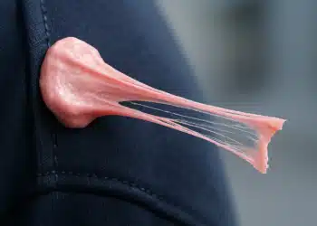 Chiclete grudado em uma roupa azul, difícil de remover