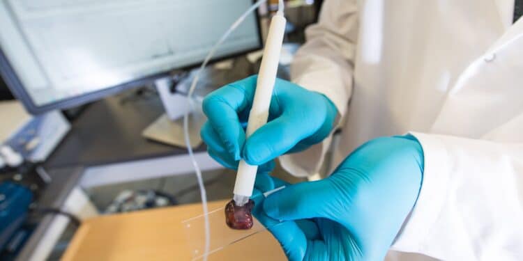 Mãos com luvas azuis segurando instrumento para analisar tecido sobre lâmina de vidro em laboratório