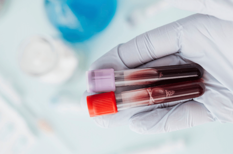 Exame de sangue: análise de biomarcadores cardíacos Tubos de ensaio com amostras de sangue, utilizados para análise de biomarcadores cardíacos.