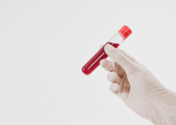 Frasco de sangue em um tubo de ensaio, simbolizando exames médicos e riscos à saúde do coração.