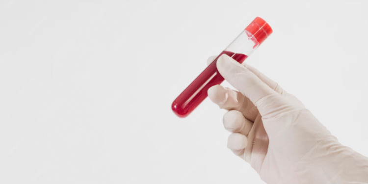 Frasco de sangue em um tubo de ensaio, simbolizando exames médicos e riscos à saúde do coração.